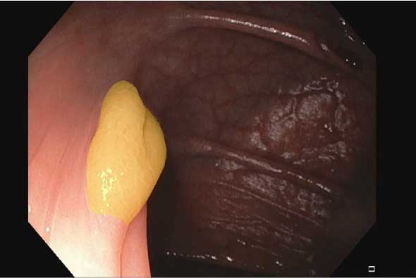 piccolo_results_human_model